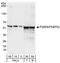 FKBP Prolyl Isomerase 4 antibody, A301-426A, Bethyl Labs, Western Blot image 