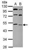Lysocardiolipin Acyltransferase 1 antibody, PA5-28498, Invitrogen Antibodies, Western Blot image 