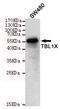Transducin Beta Like 1 X-Linked antibody, MBS475218, MyBioSource, Western Blot image 
