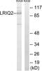 Centrosomal protein of 97 kDa antibody, A30735, Boster Biological Technology, Western Blot image 