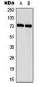 ENaCD antibody, LS-C354079, Lifespan Biosciences, Western Blot image 