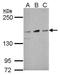 Nicastrin antibody, GTX115930, GeneTex, Western Blot image 