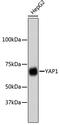 Yes Associated Protein 1 antibody, 13-985, ProSci, Western Blot image 