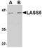 Neurogenin 2 antibody, orb6494, Biorbyt, Western Blot image 