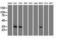 Cyclin Dependent Kinase 5 antibody, NBP1-47692, Novus Biologicals, Western Blot image 