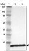 Ribosomal Protein L30 antibody, PA5-51729, Invitrogen Antibodies, Western Blot image 