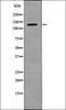 Tyrosine Kinase With Immunoglobulin Like And EGF Like Domains 1 antibody, orb335860, Biorbyt, Western Blot image 