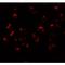 PHD Finger Protein 14 antibody, MBS153328, MyBioSource, Western Blot image 
