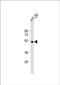 Hepatic lipase antibody, PA5-71668, Invitrogen Antibodies, Western Blot image 