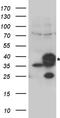 Cytochrome B5 Reductase 3 antibody, TA890109, Origene, Western Blot image 