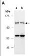Cancer Antigen 1 antibody, orb67300, Biorbyt, Western Blot image 