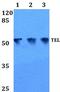 ETV6 antibody, GTX66653, GeneTex, Western Blot image 