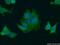 Protein LAP2 antibody, 22438-1-AP, Proteintech Group, Immunofluorescence image 
