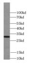 Septin-4 antibody, FNab07723, FineTest, Western Blot image 