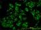 Acyl-CoA Binding Domain Containing 3 antibody, H00064746-M01, Novus Biologicals, Immunofluorescence image 