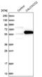Calcium-binding and coiled-coil domain-containing protein 2 antibody, NBP1-87873, Novus Biologicals, Western Blot image 