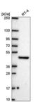 FIC Domain Containing antibody, NBP2-58855, Novus Biologicals, Western Blot image 