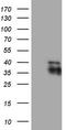 Endogenous Bornavirus Like Nucleoprotein 2 antibody, LS-C798617, Lifespan Biosciences, Western Blot image 