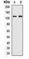 Synaptopodin antibody, LS-C668440, Lifespan Biosciences, Western Blot image 