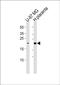 KDEL Endoplasmic Reticulum Protein Retention Receptor 2 antibody, PA5-49559, Invitrogen Antibodies, Western Blot image 
