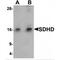 Succinate dehydrogenase [ubiquinone] cytochrome b small subunit, mitochondrial antibody, MBS150810, MyBioSource, Western Blot image 