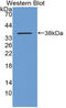 Metallothionein-1 antibody, LS-C691963, Lifespan Biosciences, Western Blot image 