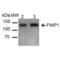 Folliculin Interacting Protein 1 antibody, LS-C773240, Lifespan Biosciences, Western Blot image 