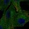 Platelet Derived Growth Factor Receptor Beta antibody, HPA028499, Atlas Antibodies, Immunocytochemistry image 