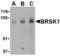 BR Serine/Threonine Kinase 1 antibody, TA306411, Origene, Western Blot image 