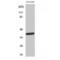 Neuronal Growth Regulator 1 antibody, LS-C384805, Lifespan Biosciences, Western Blot image 