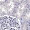 Chromosome 16 Open Reading Frame 89 antibody, PA5-53071, Invitrogen Antibodies, Immunohistochemistry paraffin image 