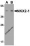 NK2 Homeobox 1 antibody, 6741, ProSci, Western Blot image 