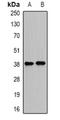Proline/serine-rich coiled-coil protein 1 antibody, orb340925, Biorbyt, Western Blot image 