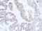 SATB Homeobox 1 antibody, NBP2-15107, Novus Biologicals, Immunohistochemistry frozen image 