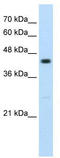 Ring Finger Protein 32 antibody, TA330476, Origene, Western Blot image 