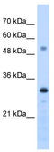 Proteasome activator complex subunit 3 antibody, TA339291, Origene, Western Blot image 