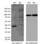 Alcohol dehydrogenase [NADP+] antibody, GTX84915, GeneTex, Western Blot image 