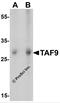 TATA-Box Binding Protein Associated Factor 9 antibody, 7719, ProSci, Western Blot image 
