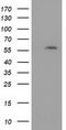 Dystrobrevin Alpha antibody, CF502258, Origene, Western Blot image 