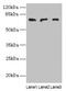 Phospholipase C Zeta 1 antibody, LS-C398864, Lifespan Biosciences, Western Blot image 