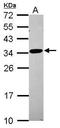 Ribosomal Protein L8 antibody, GTX117934, GeneTex, Western Blot image 