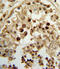 Hydroxysteroid 17-Beta Dehydrogenase 3 antibody, LS-C165035, Lifespan Biosciences, Immunohistochemistry frozen image 