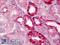 BCL2 antibody, LS-B6548, Lifespan Biosciences, Immunohistochemistry frozen image 