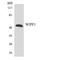 WAS/WASL Interacting Protein Family Member 1 antibody, LS-C200820, Lifespan Biosciences, Western Blot image 
