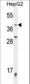 Zinc Finger Protein 763 antibody, LS-C160942, Lifespan Biosciences, Western Blot image 