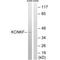 Potassium Two Pore Domain Channel Subfamily K Member 15 antibody, A12818, Boster Biological Technology, Western Blot image 