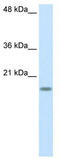 40S ribosomal protein S14 antibody, TA345749, Origene, Western Blot image 