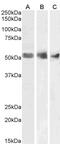 Von Hippel-Lindau Tumor Suppressor antibody, 45-170, ProSci, Immunohistochemistry paraffin image 