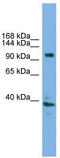 Vacuolar adenosine triphosphatase subunit Ac116 antibody, TA342323, Origene, Western Blot image 