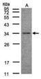 HAD antibody, PA5-28035, Invitrogen Antibodies, Western Blot image 